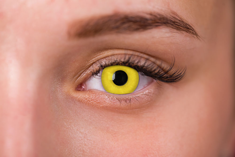 Woman Wearing Lunatic Zombie Yellow Contacts