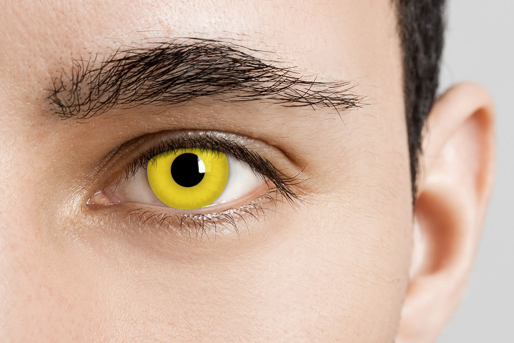 Man Wearing Lunatic Zombie Yellow Contacts